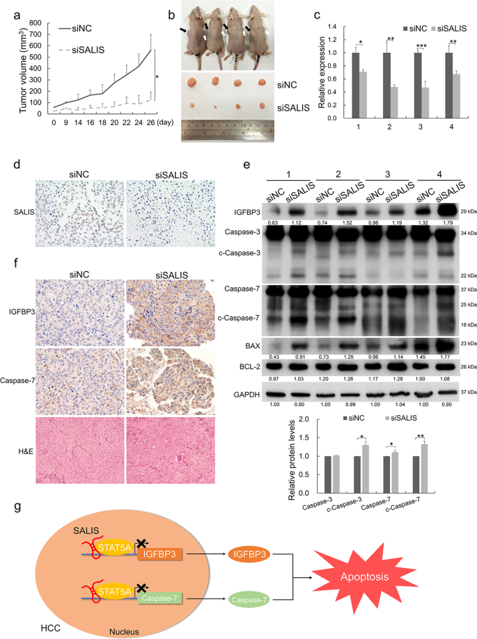 Fig. 7: Loss of SALIS enhances apoptosis and compromises the growth of HCC in vivo.