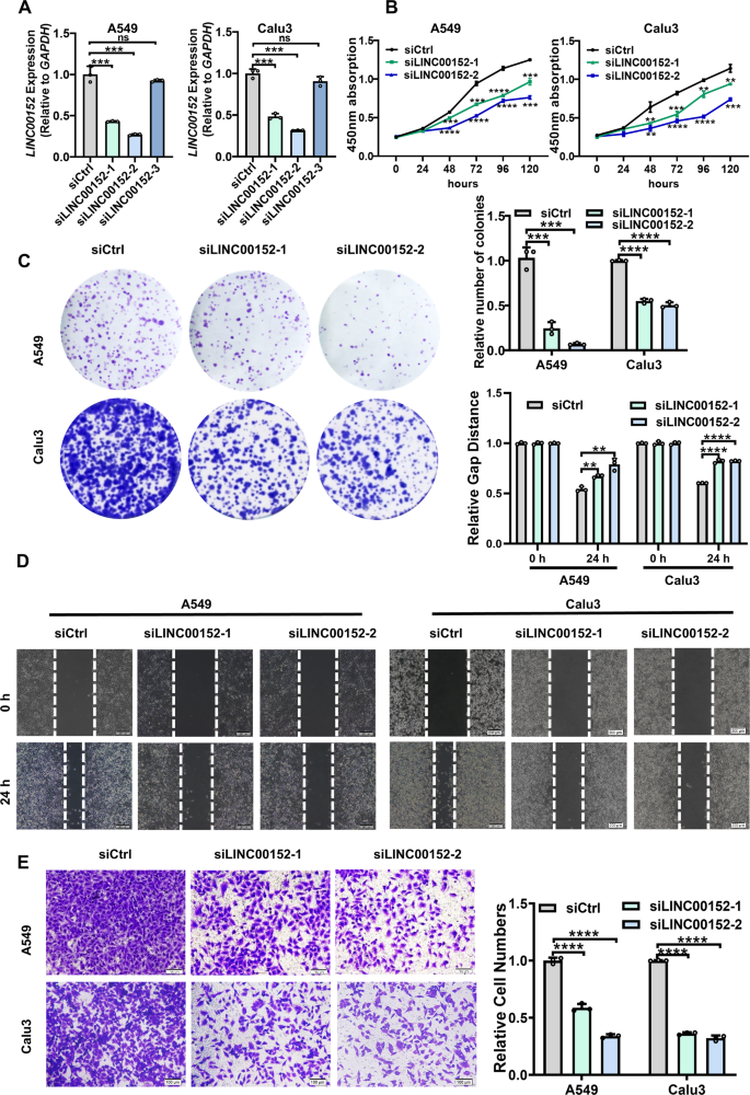 Fig. 4: Knockdown of LINC00152 inhibits the survival, invasion and migration of LUAD cells in vitro.