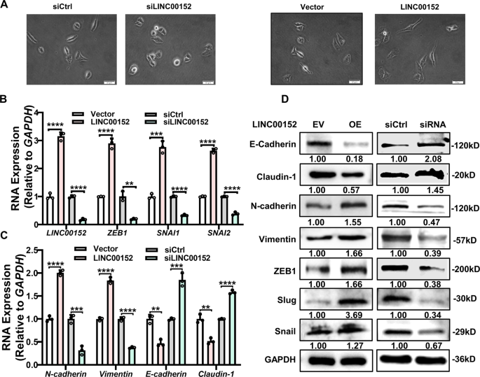 Fig. 6: LINC00152 promotes EMT of LUAD cells.