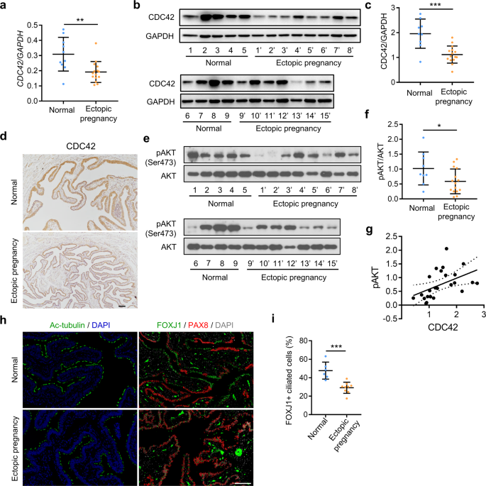 Fig. 7: Decreased levels of oviduct CDC42 and phosphor-AKT in women with ectopic pregnancy.