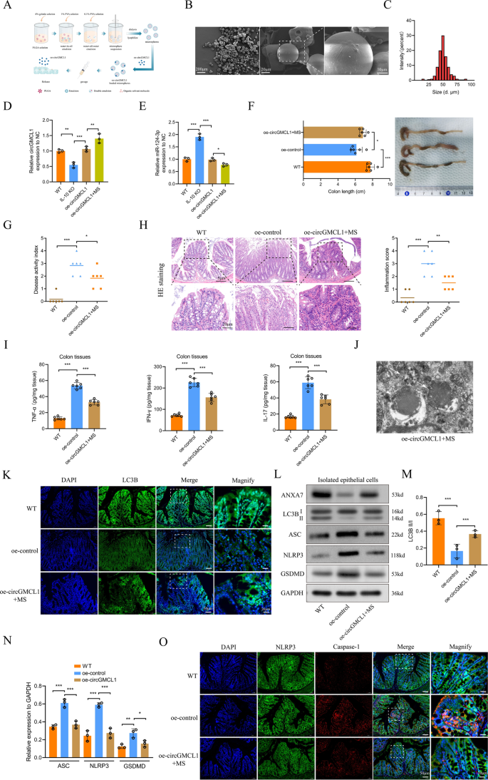 Fig. 6: In vivo effects of circGMCL1 in IL-10 KO mice against colitis.