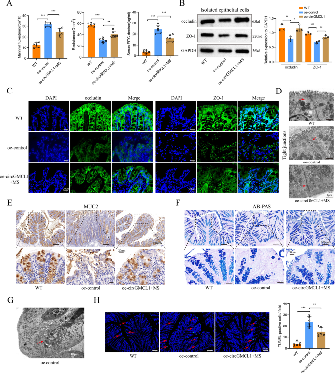 Fig. 7: Impact of circGMCL1 on intestinal barrier function.