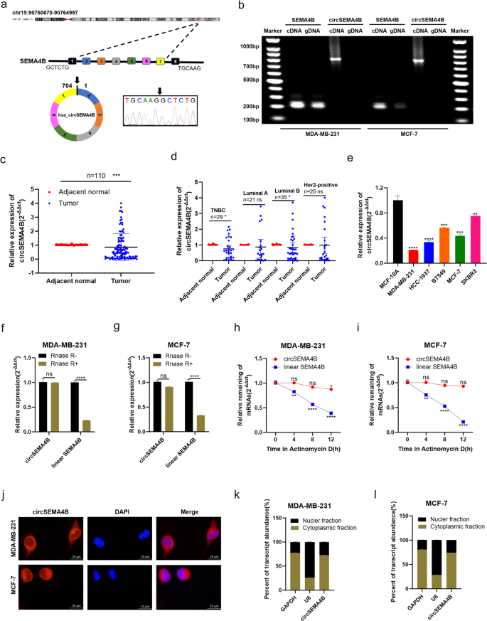 Fig. 1: Characterization of circSEMA4B in BC tissues and cell lines.
