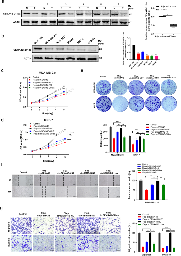 Fig. 4: SEMA4B-211aa acts as a tumor suppressor in BC cells.