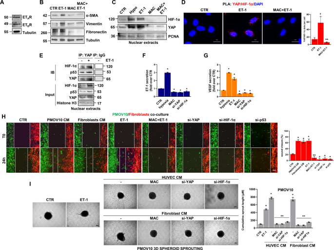 Fig. 5: The ET-1-triggered p53/YAP/HIF-1α circuit mediates HG-SOC/activated fibroblast interplay.