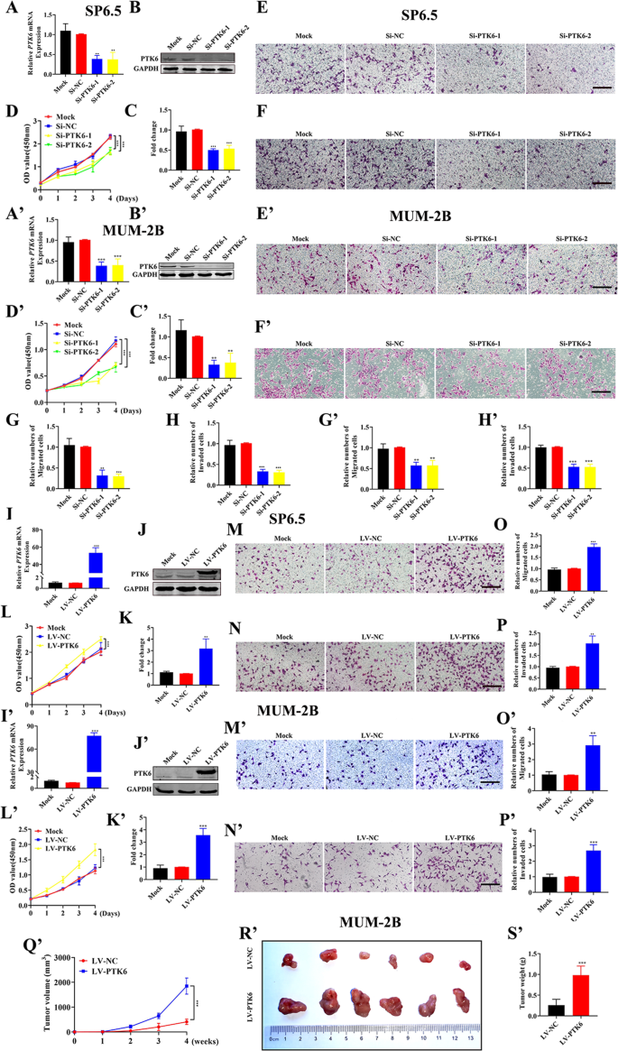 Fig. 2: PTK6 promotes the proliferation, migration, and invasion of UM cells in vitro and in vivo.