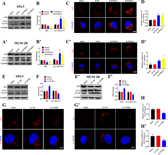 Fig. 3: PTK6 inhibits autophagy in UM cells.