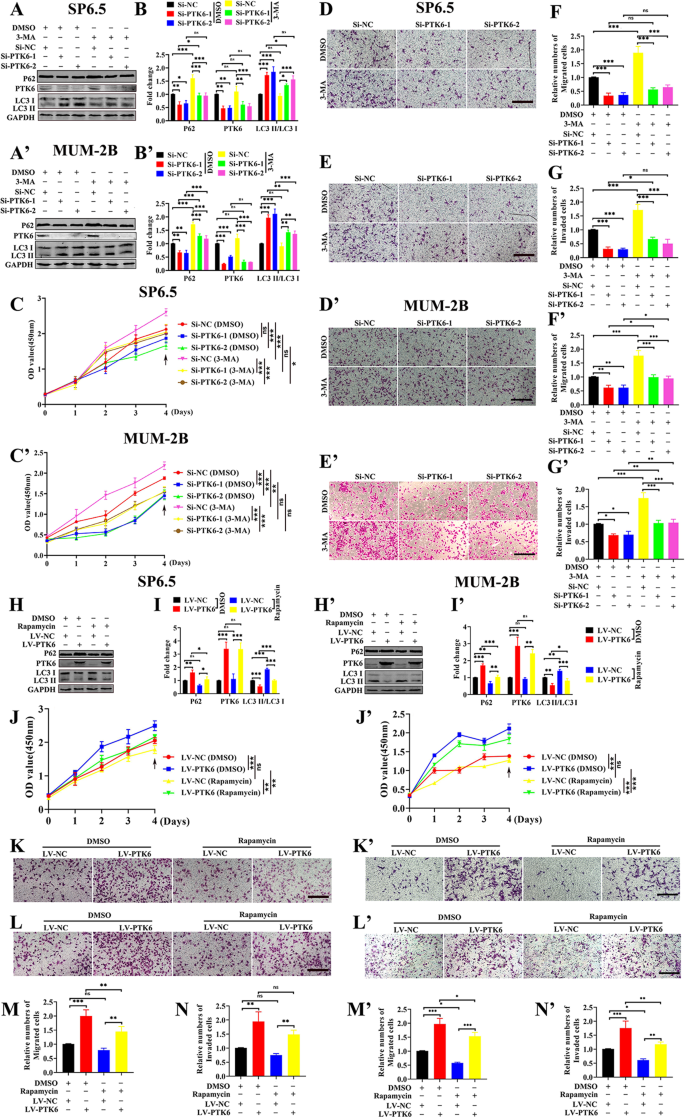 Fig. 4: PTK6 promotes the proliferation, migration, and invasion of UM cells by inhibiting autophagy.