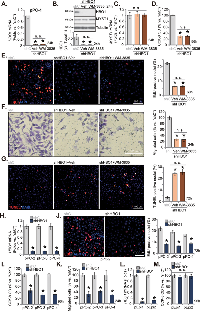 Fig. 3: HBO1 silencing inhibits primary CRPC cell viability, proliferation and migration in vitro.