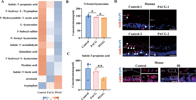 Fig. 1: Tryptophan metabolites and retinal AhR were abnormally expressed in glaucoma patients.