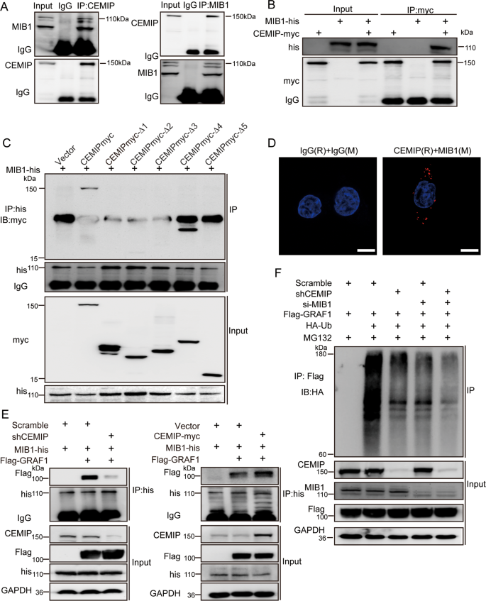 Fig. 4: CEMIP acts as a scaffold protein in bridging GRAF1 and MIB1 which is critical to GRAF1 degradation.