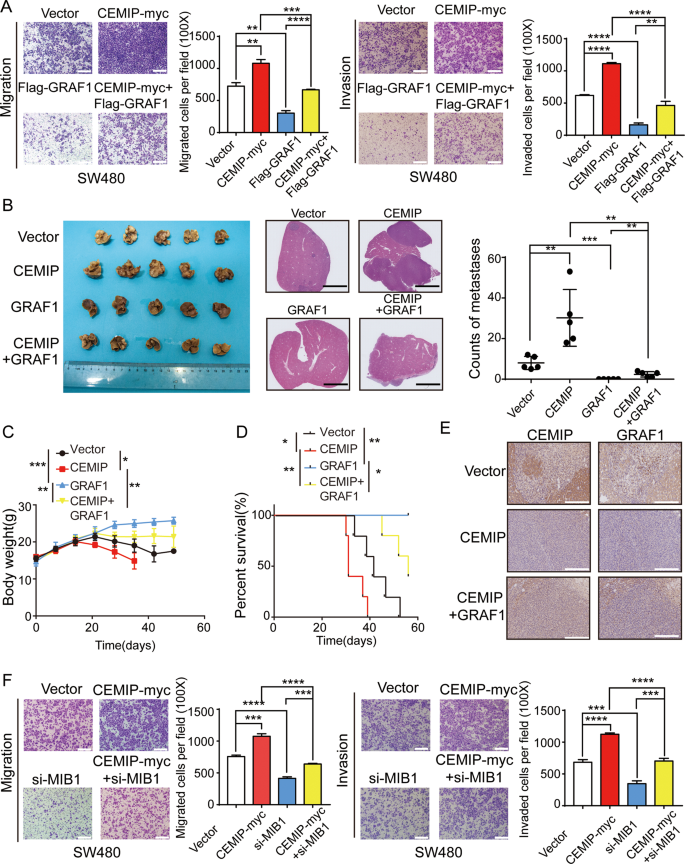 Fig. 5: CEMIP promotes metastasis of CRC cells by bridging GRAF1 and MIB1.