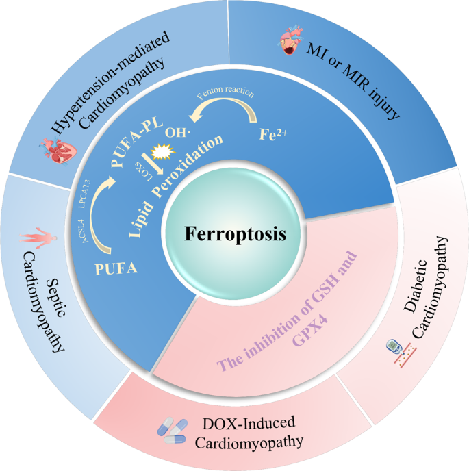Fig. 3: The main ferroptosis mechanisms in various types of cardiomyopathies.