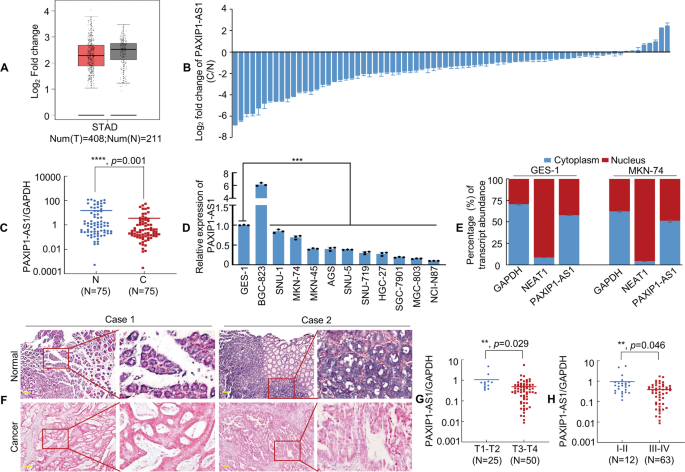 Fig. 2: PAXIP1-AS1 expression is downregulated in GC cell lines and tissues.