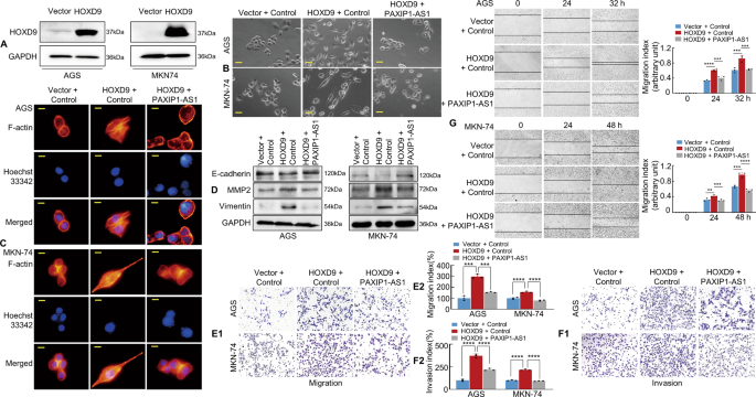 Fig. 4: HOXD9-PAXIP1-AS1 axis regulates the migration and invasion of GC cells in vitro.