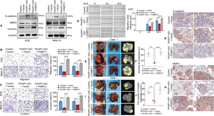 Fig. 6: PAXIP1-AS1 with PABPC1 regulates migration and invasion of GC cells.