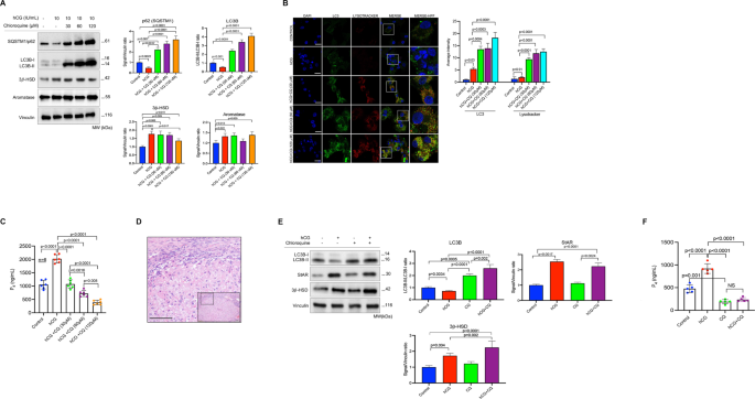 Fig. 2: Pharmacological inhibition of autophagy with chloroquine (CQ) impairs steroidogenesis in luteinized granulosa cells and corpus luteum tissue samples.