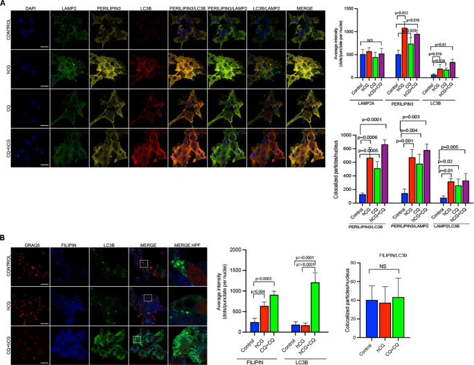 Fig. 5: Lipid droplets but not free cholesterol associate with autophagosome.