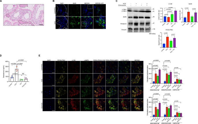 Fig. 6: Pharmacological inhibition of autophagy with chloroquine (CQ) impairs testosterone production in testicular tissue samples.