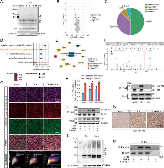 Lactate induces vascular permeability via disruption of VE-cadherin in  endothelial cells during sepsis