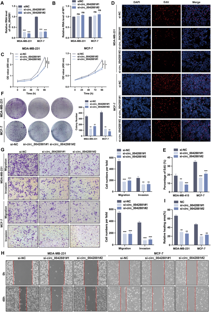 Fig. 2: Knockdown of circ_0042881 suppresses BC progression.