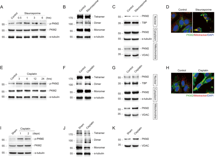 Fig. 1: Mitochondrial PKM2 is increased in tubular epithelial cells during AKI.