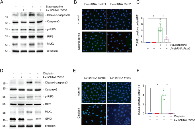 Fig. 3: Down-regulation of PKM2 expression alleviates renal tubular cell death in vitro.