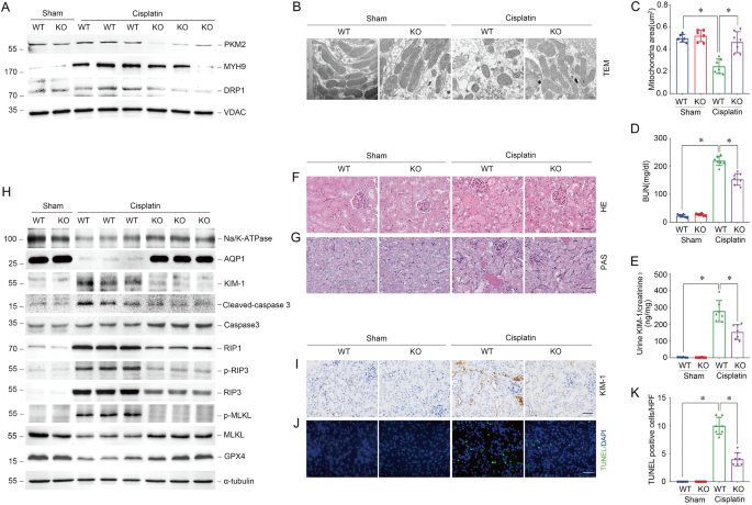Fig. 5: Deletion of PKM2 in tubular epithelial cells inhibits mitochondrial fragmentation and alleviates cisplatin-induced AKI in vivo.