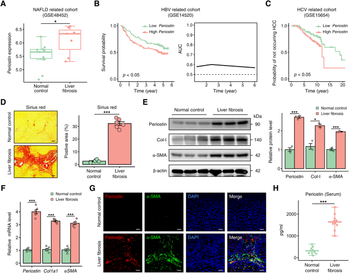 Fig. 4: Periostin is elevated in liver fibrosis patients.