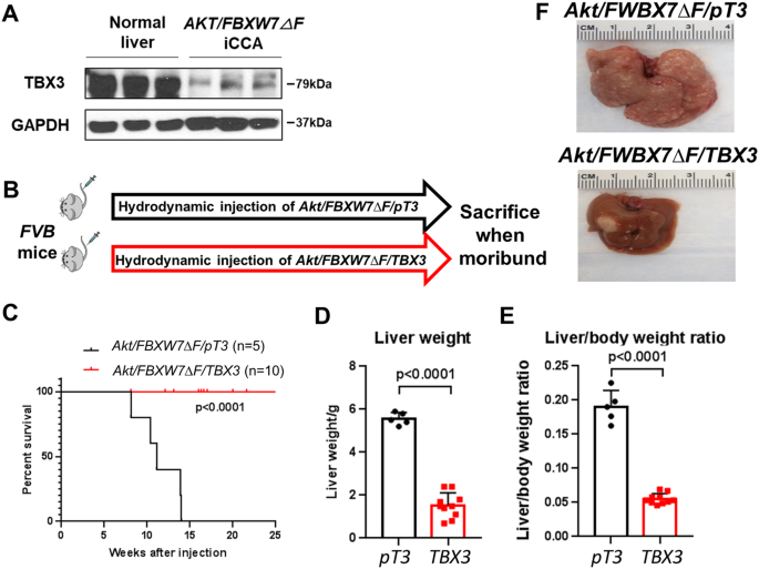 Fig. 2: Overexpression of TBX3 inhibits mouse iCCA growth.