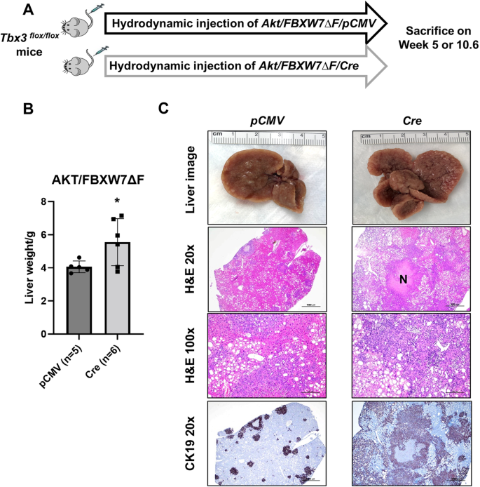Fig. 4: Knocking down Tbx3 accelerates iCCA tumor development in the Akt/FBXW7ΔF model.