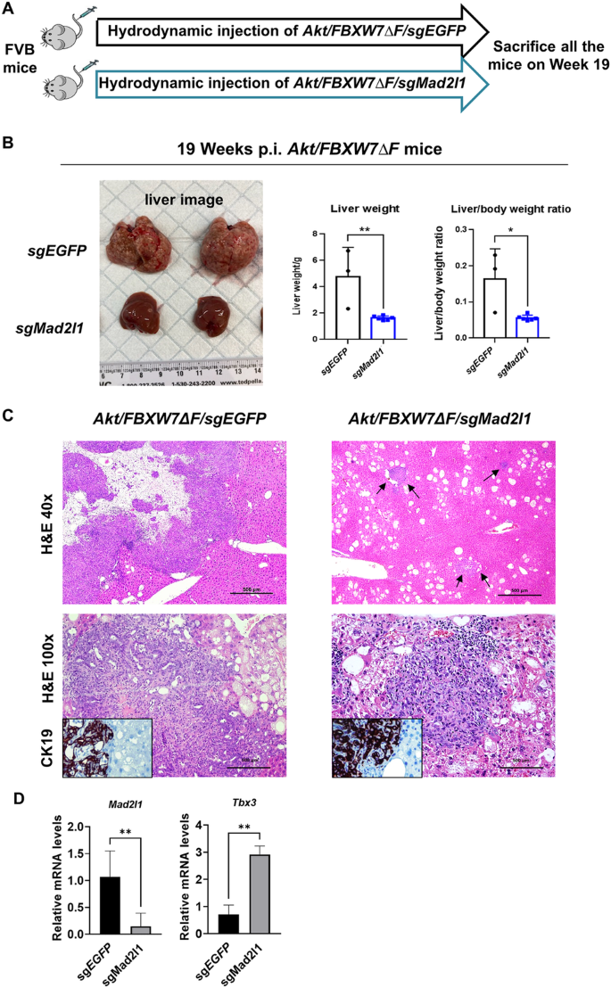 Fig. 6: Deletion of Mad2l1 hampers Akt/FBXW7ΔF-driven cholangiocarcinogenesis.