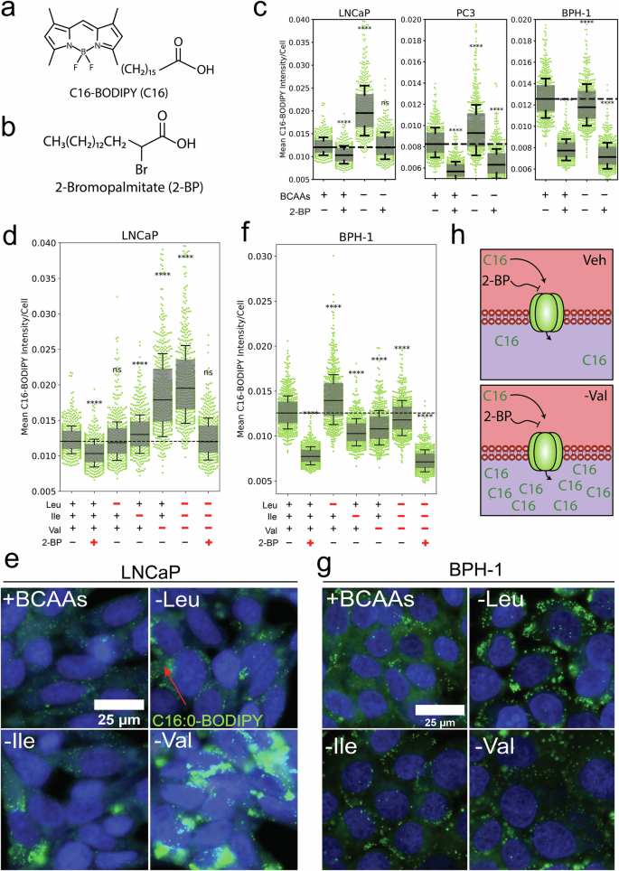 Fig. 2: Extracellular valine co-regulates long-chain fatty acid uptake in PCa cells.