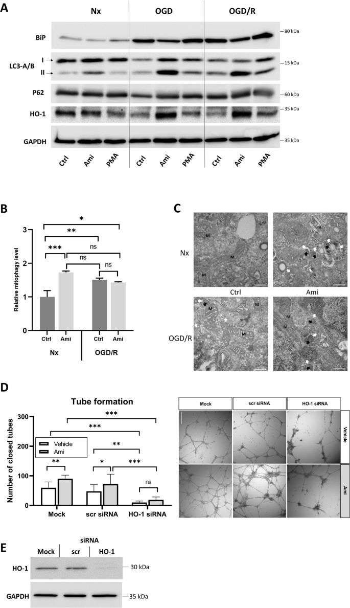 Fig. 6: Amitriptyline reduces cerebral endothelial endoplasmic reticulum stress, stimulates autophagy/ mitophagy and heme oxygenase-1 (HO-1)-dependent antioxidant responses, which are instrumental for amitriptyline’s angiogenic effects.