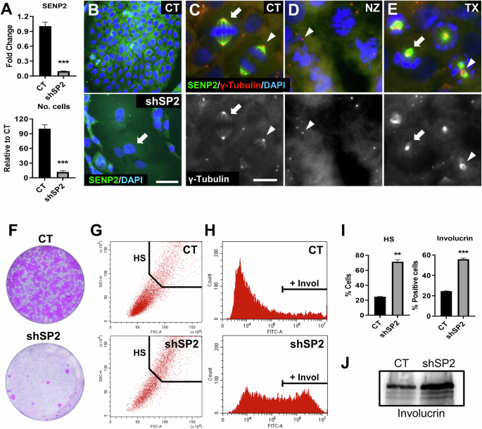 Fig. 2: Silencing of SENP2 causes a rapid loss of proliferative capacity and differentiation in human primary epidermal cells.