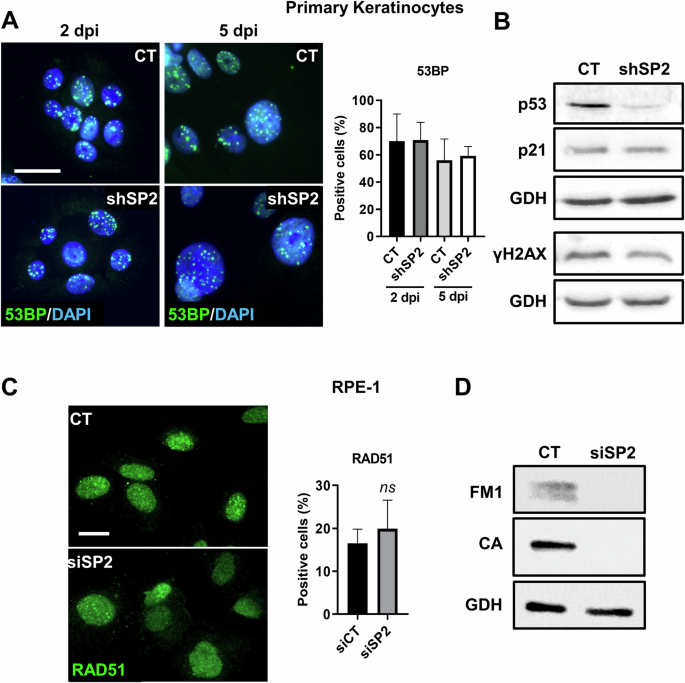 Fig. 4: Cell cycle defects induced by SENP2 silencing do not activate a DNA damage response.