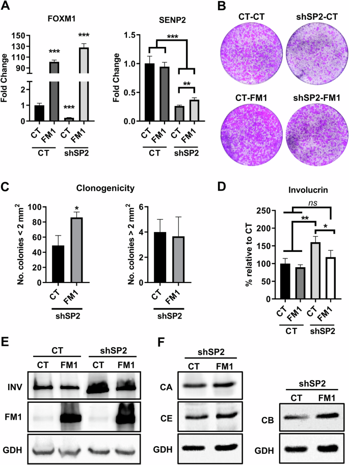Fig. 6: Mitosis exit driven by FOXM1 relieves differentiation caused by SENP2 depletion in primary keratinocytes.