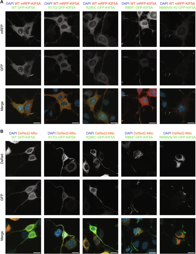 alternative hypothesis example in statistics figure 4