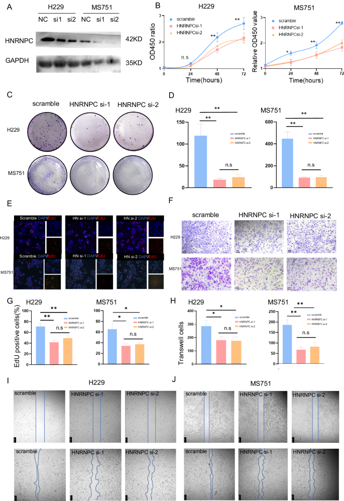 Fig. 2: Impact of HNRNPC Downregulation on CCa Cell Proliferation, Invasion, and Migration In Vitro.