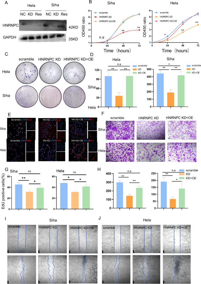 Fig. 3: HNRNPC drives proliferation, invasion, and migration of CCa cells in vitro.