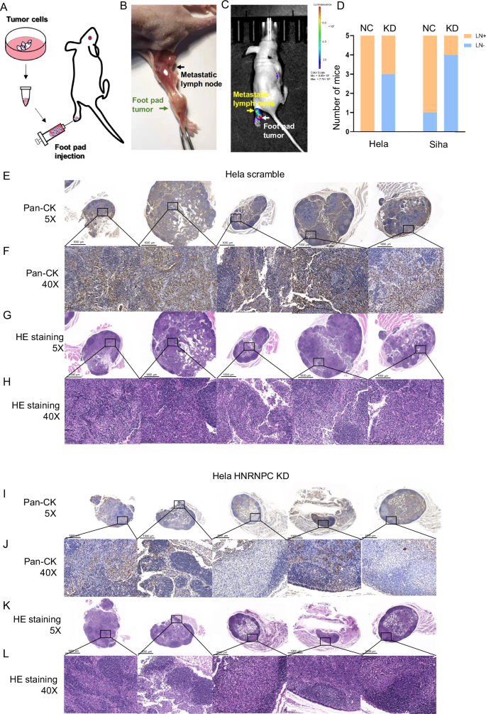 Fig. 4: HNRNPC facilitates CCa metastasis to regional lymph nodes in vivo through the footpad-popliteal lymphatic metastasis model.