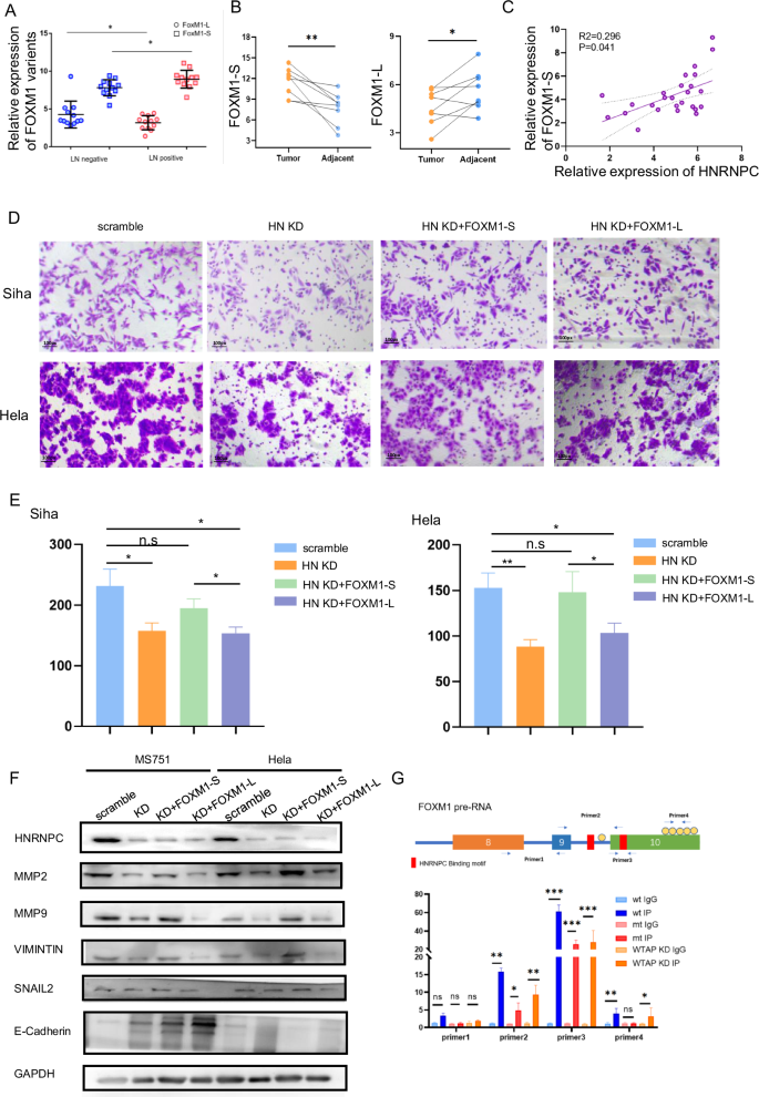 Fig. 6: HNRNPC-Mediated Increase in FOXM1-S Variant Plays a Crucial Role in CCa Metastasis.