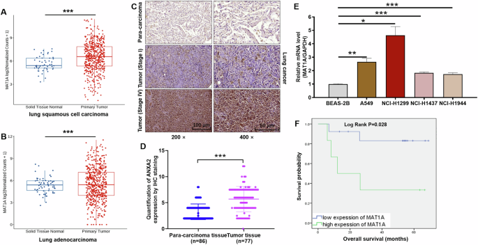 Fig. 1: MAT1A was abundantly expressed in NSCLC and associated with prognosis of NSCLC patients.