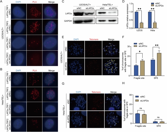 Fig. 1: LAP2α interacted with shelterin complex and LAP2α deficiency induced dysfunctional telomeres of ALT-positive cells.