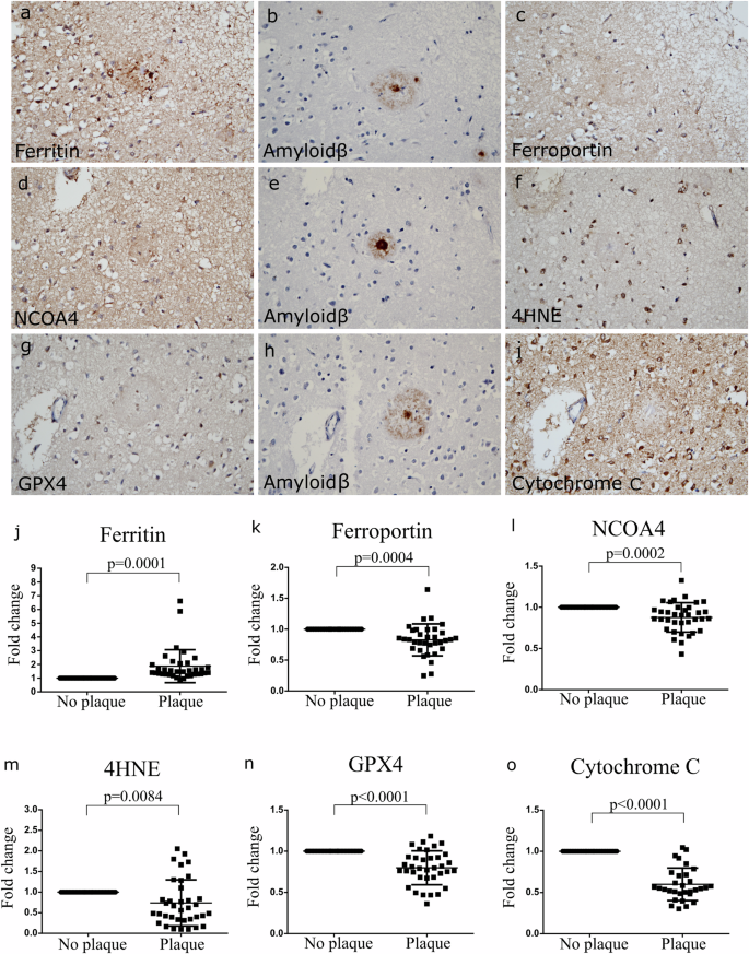 The link between amyloid and ferroptosis pathway in Alzheimer's disease progression | Cell Death & Disease The link between amyloid and ferroptosis pathway in Alzheimer's disease progression | Cell Death & Disease