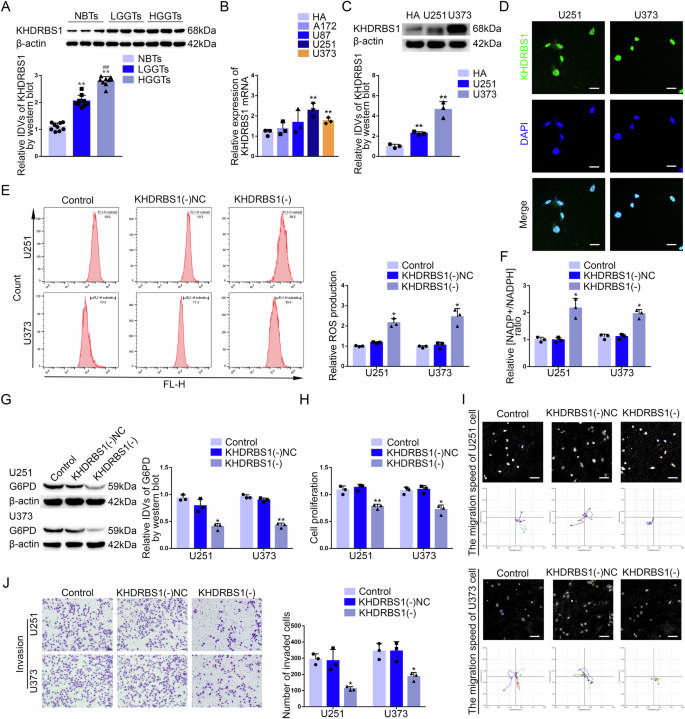 Fig. 1: KHDRBS1 was upregulated in GBM tissues and cells, promoting the PPP and biological behavior of GBM cells.