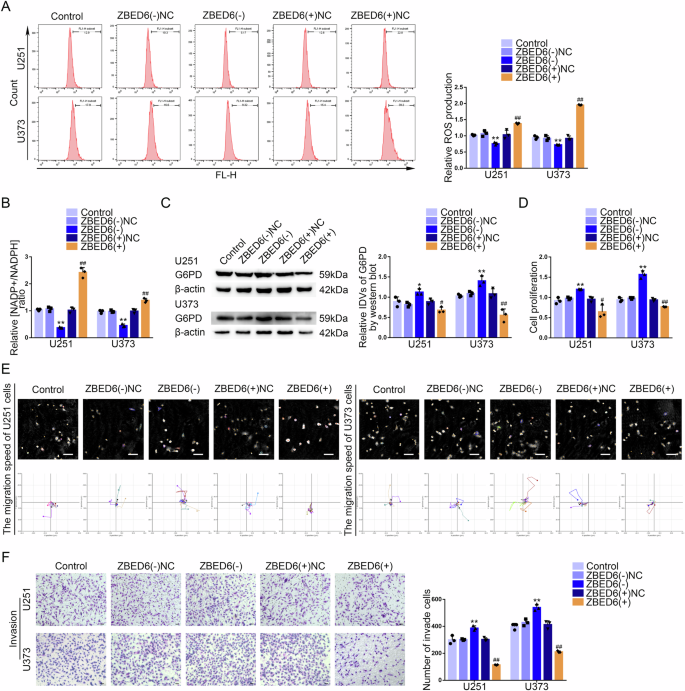 Fig. 4: ZBED6, as a tumor suppressor, inhibited the PPP and biological behavior of GBM cells.