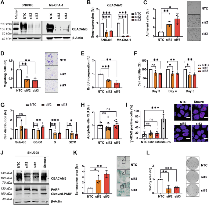 Fig. 2: CEACAM6 knockdown inhibits GBC oncogenic phenotype.