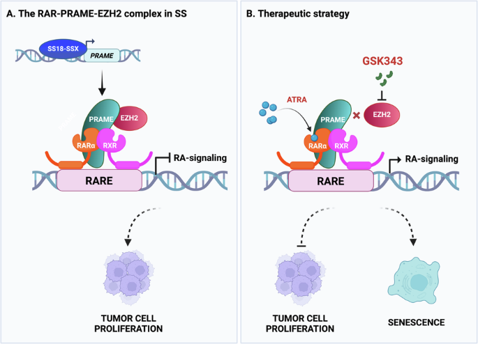 EZH2 inhibition sensitizes retinoic acid-driven senescence in synovial ...