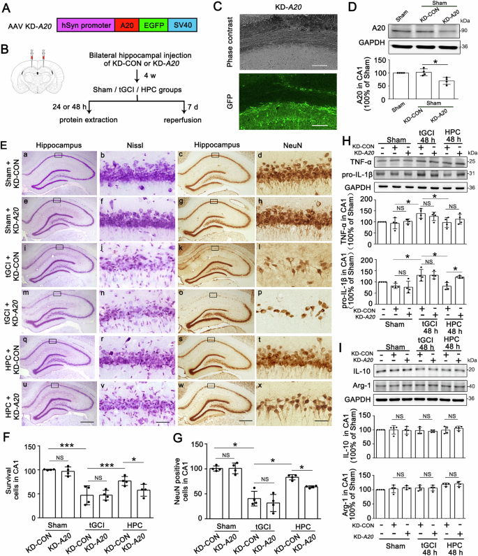 Fig. 4: Silencing of A20 abolishes the HPC-induced neuroprotection in CA1 after tGCI.